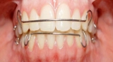 Is It Tough To Achieve Success In Fixed Retainer?