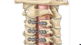 Best Cervical Spine Surgeon in India Explains the Benefits of Personalized Surgical Planning