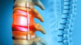 Best Neuro Spine Surgeon in Kolkata – Expert Care