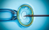 In-Vitro Fertilization (Ivf) Devices Market – Global Trends, Growth, Opportunities, and Market Forecast to 2025